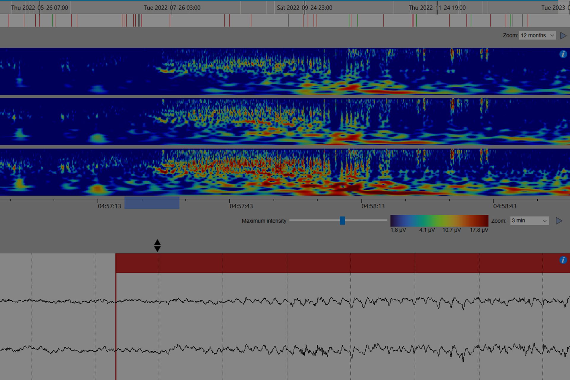 UNEEG-EpiSight-Analyzer_review_service2.jpg