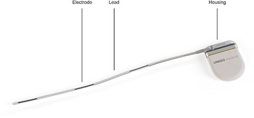 Uneeg_Product_ImplnatID_10_EN.jpg